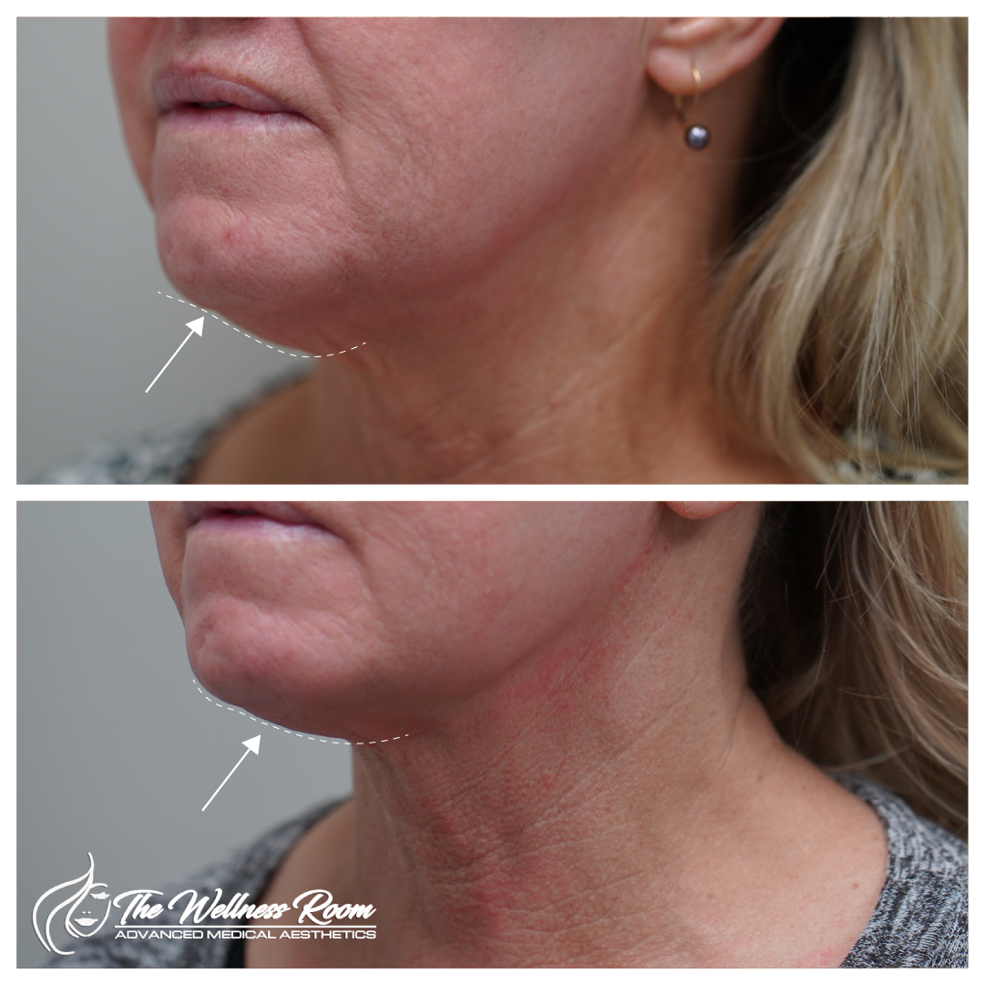 The Wellness Room Skin Wellness Center Knoxville