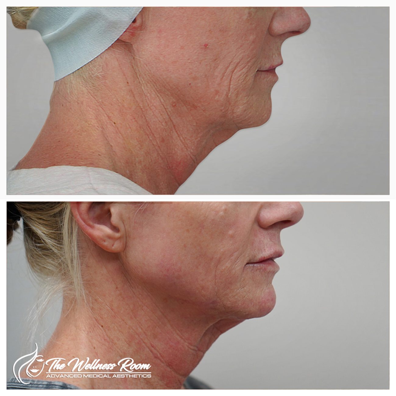 The Wellness Room Skin Wellness Center Knoxville