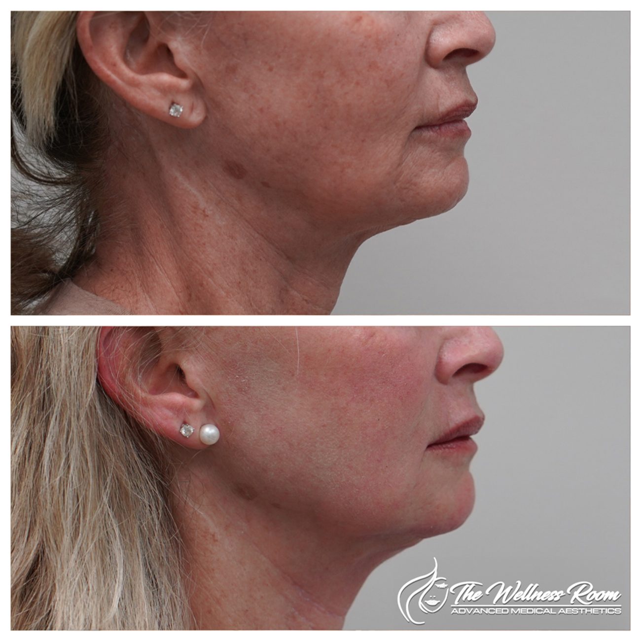 The Wellness Room Skin Wellness Center Knoxville