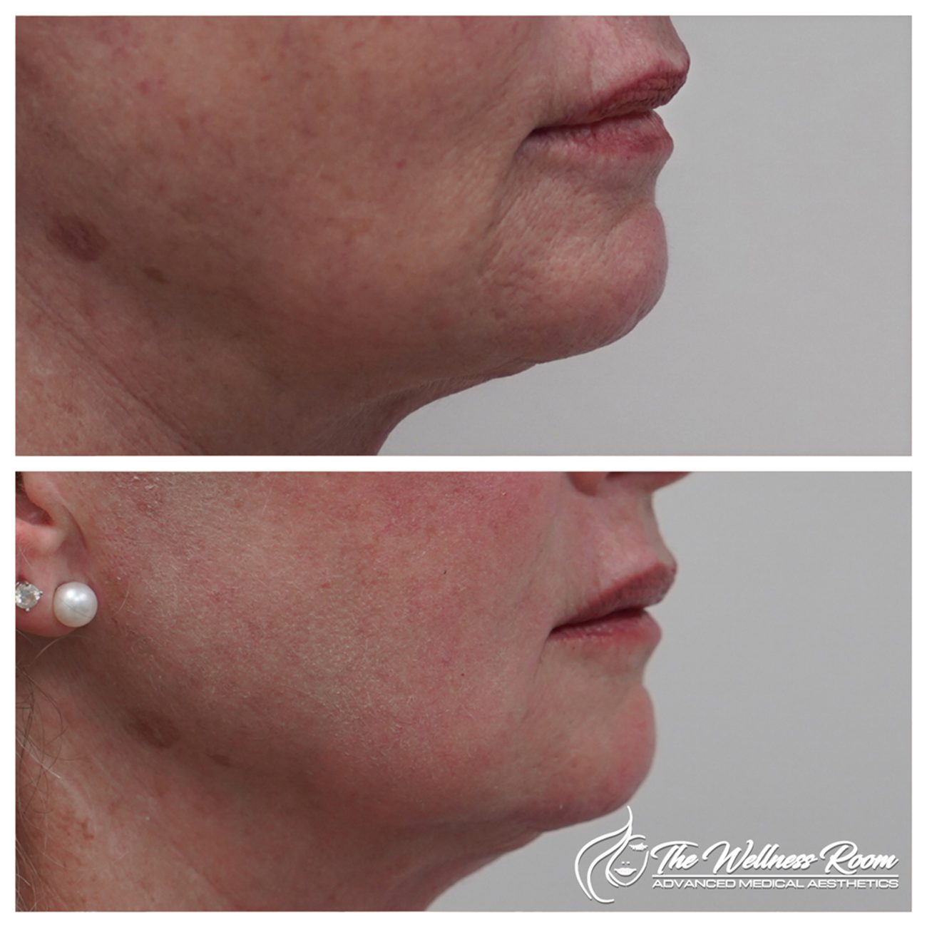 The Wellness Room Skin Wellness Center Knoxville