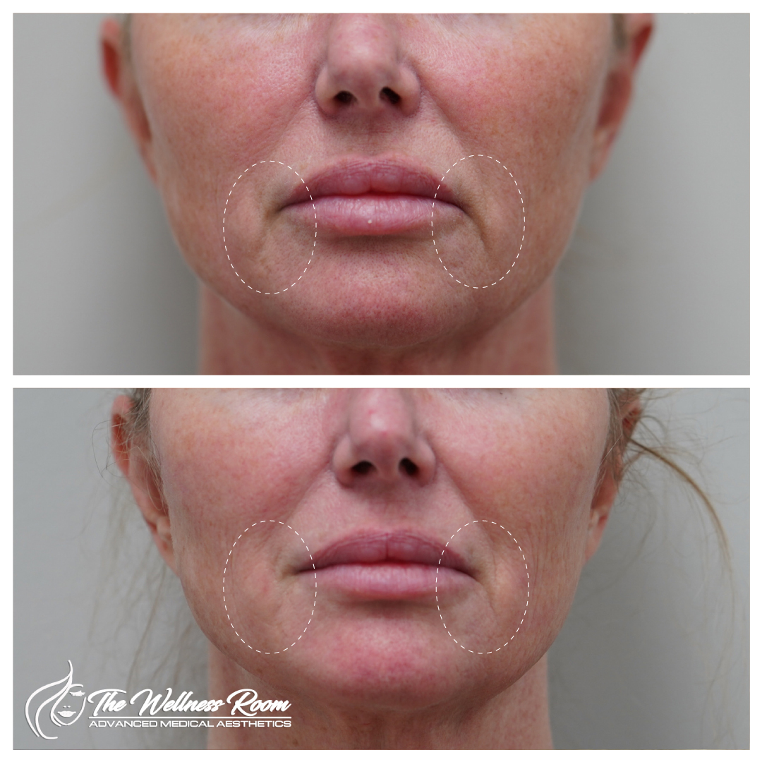 The Wellness Room Skin Wellness Center Knoxville