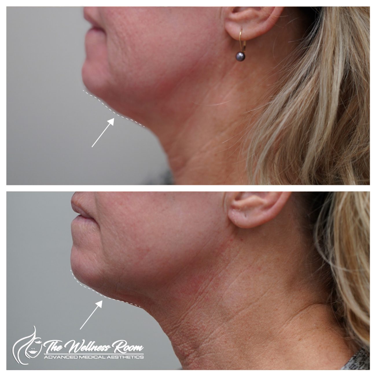 The Wellness Room Skin Wellness Center Knoxville