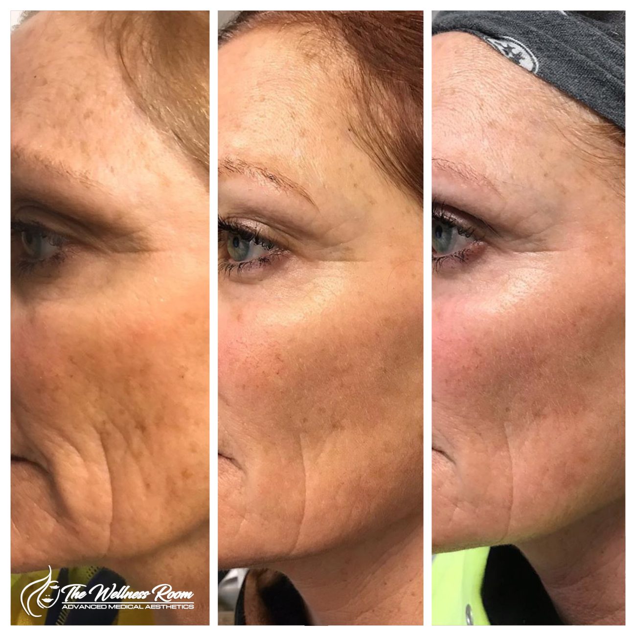 The Wellness Room Skin Wellness Center Knoxville