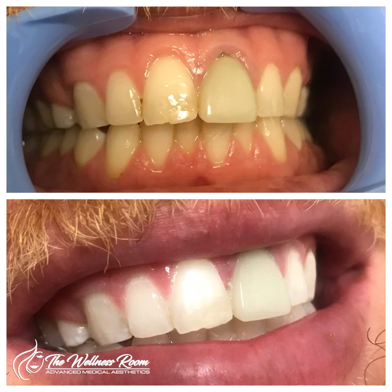 The Wellness Room Skin Wellness Center Knoxville