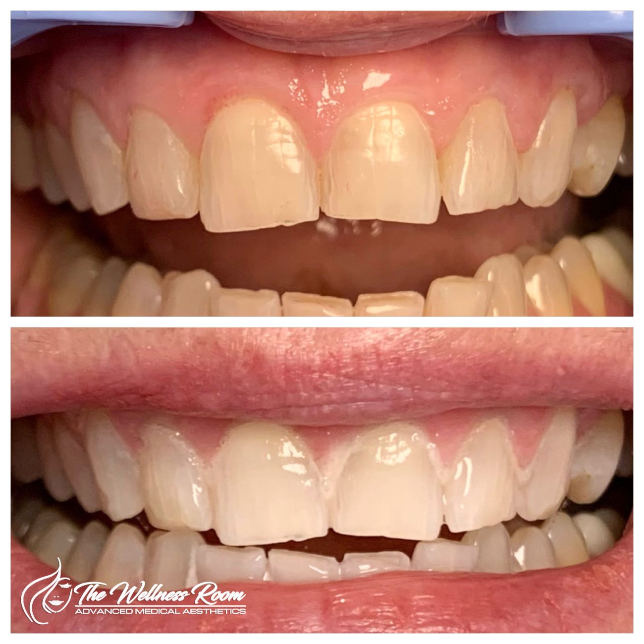 The Wellness Room Skin Wellness Center Knoxville