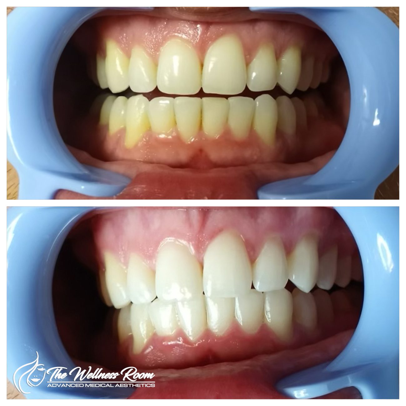 The Wellness Room Skin Wellness Center Knoxville