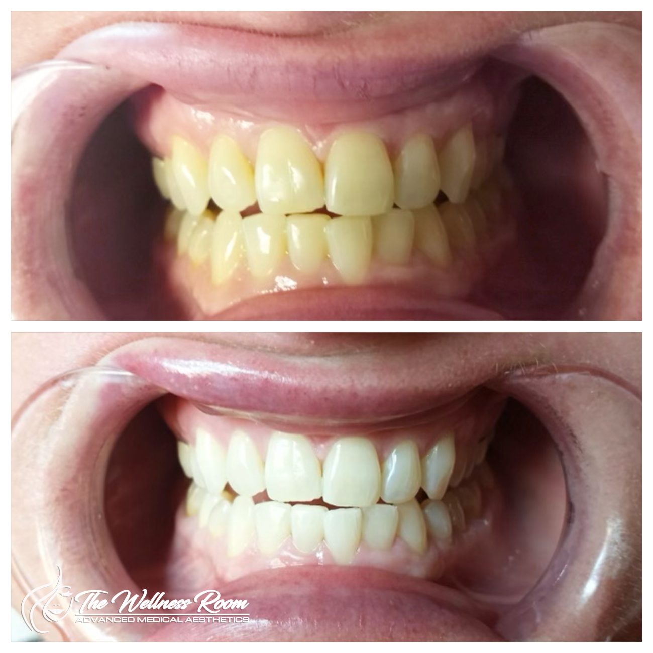 The Wellness Room Skin Wellness Center Knoxville