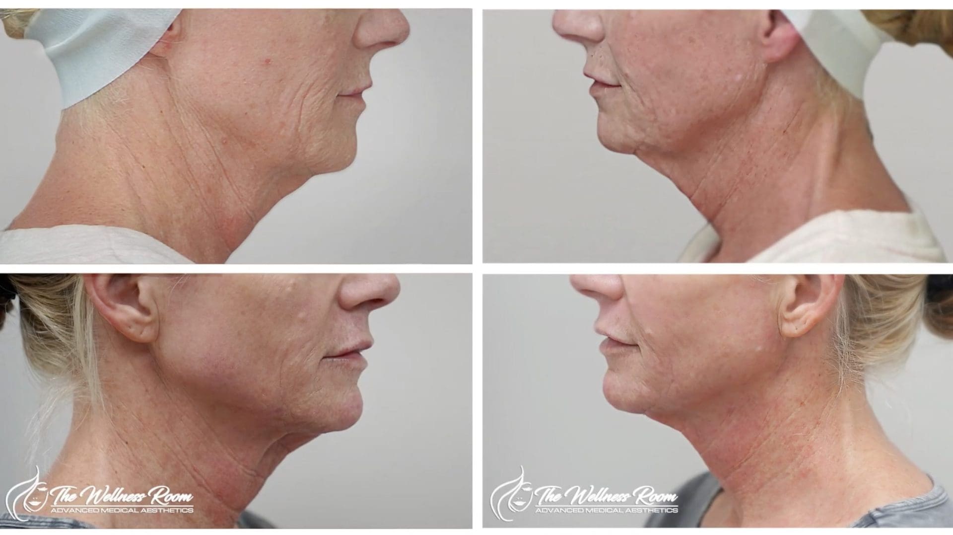 The Wellness Room Skin Wellness Center Knoxville